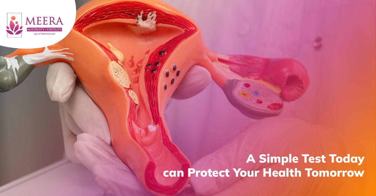 pap-smear-test-cervical-cancer-screening-guide